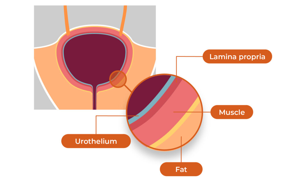 BCANLayersofthebladderwall Bladder Cancer Advocacy Network