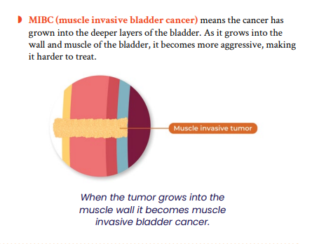 Diagram illustrating muscle invasive bladder cancer (MIBC). It shows a cross-section of the bladder wall with layers depicted in different colors. A highlighted section labeled "muscle invasive tumor" penetrates into the bladder muscle, indicating increased aggressiveness. Text explains MIBC as cancer growing into deeper bladder layers.