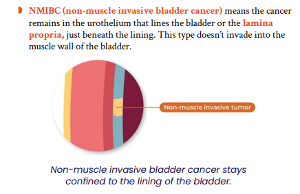 Diagram illustrating muscle invasive bladder cancer (MIBC). It shows a cross-section of the bladder wall with layers depicted in different colors. A highlighted section labeled "muscle invasive tumor" penetrates into the bladder muscle, indicating increased aggressiveness. Text explains MIBC as cancer growing into deeper bladder layers.