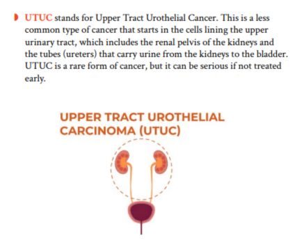 The image includes text explaining that UTUC stands for Upper Tract Urothelial Cancer, describing it as a rare cancer affecting the upper urinary tract. Below the text, there is a diagram showing the kidneys, ureters, and bladder, labeled as "Upper Tract Urothelial Carcinoma (UTUC)." The diagram highlights the urinary system components involved in UTUC.